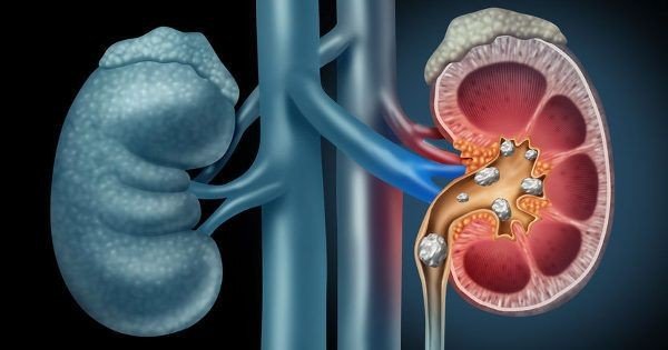 Kidney Synonyms: